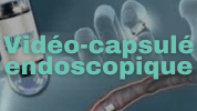 Vidéo-capsulé endoscopique Dr Lahbabi Mounia Gastro Fès