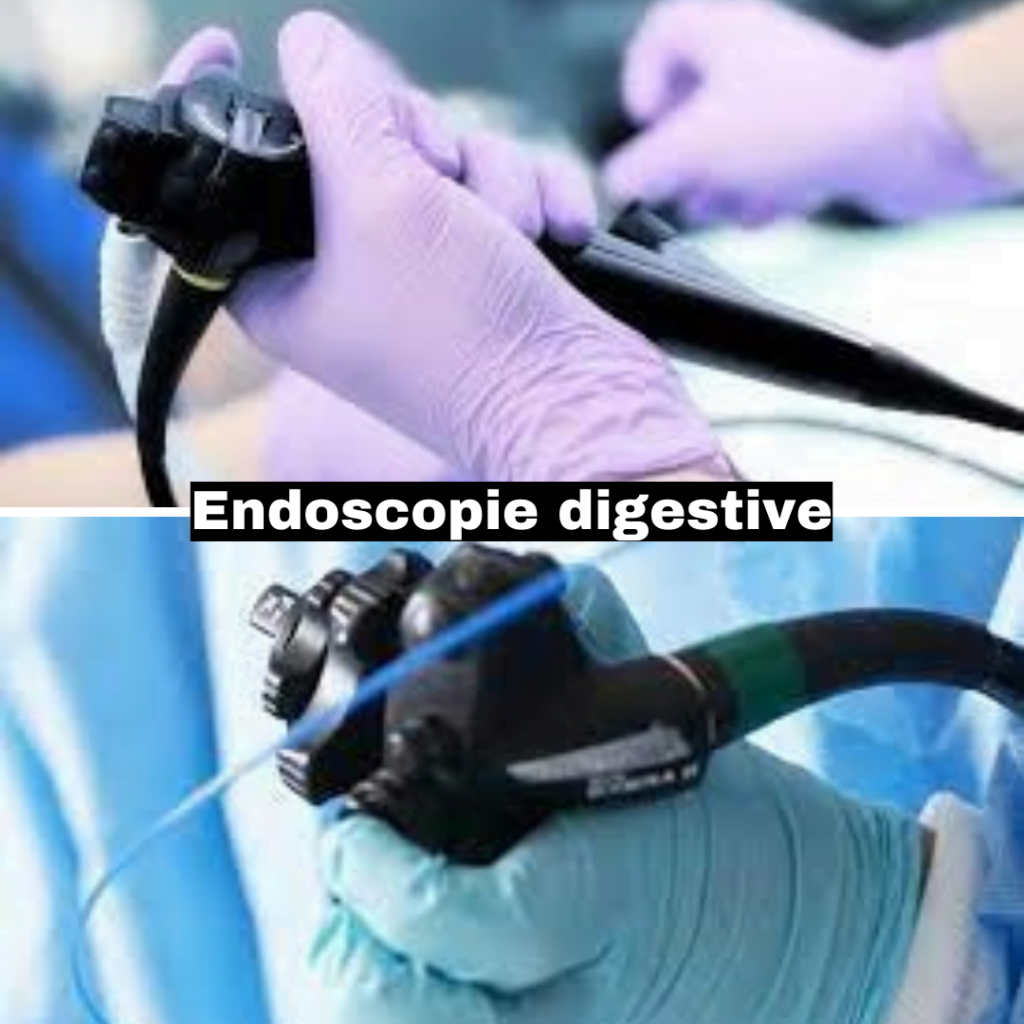 endoscopie endoscopie digestive endoscopie fes maroc endoscopie digestive prix maroc