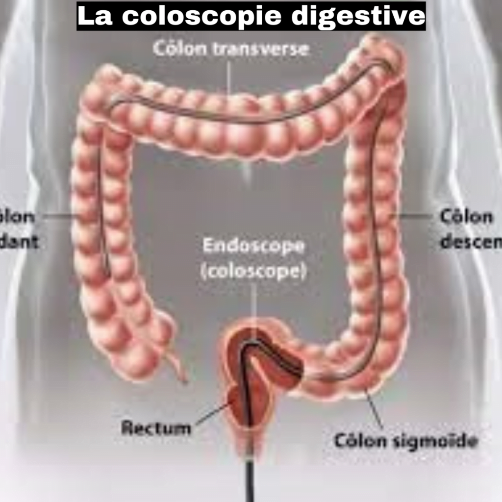 La coloscopie digestive dr lahbabi mounia La coloscopie digestive La coloscopie digestive Fès La coloscopie digestive Fes La coloscopie digestive maroc