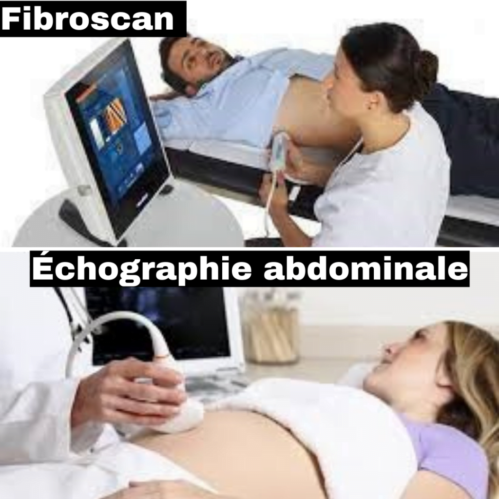 HEPATOLOGIE. fibroscan échoghraphie abdominale gastro fes